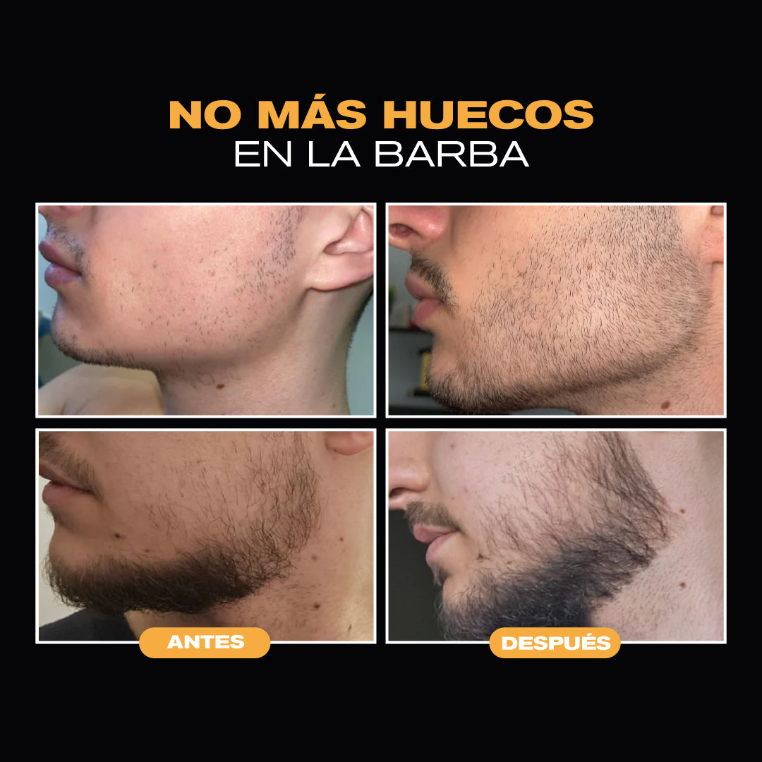 Kit Crecimiento de Barba & Cabello