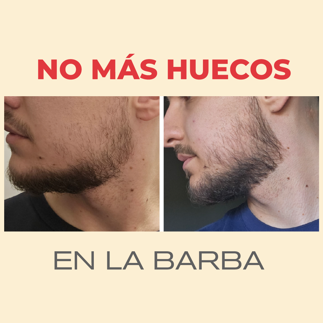 Kit Crecimiento de Barba & Cabello